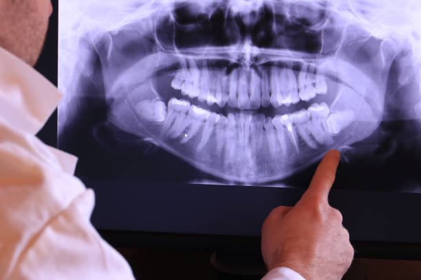 Best Knocked-Out Tooth Emergency  in Powells Crossroads, TN