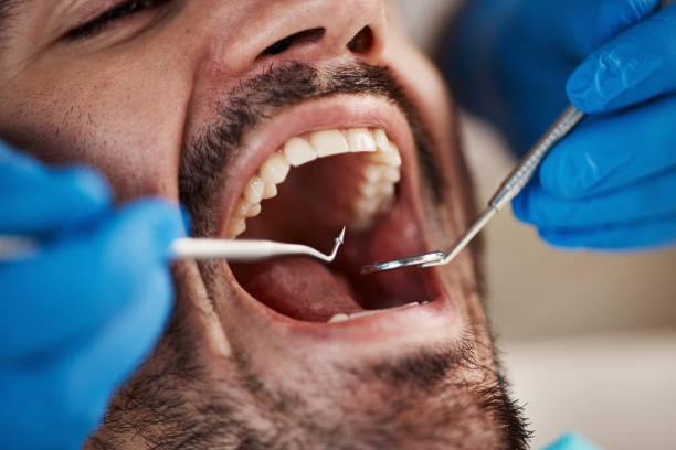 Best Dentist for Tooth Abscess  in Powells Crossroads, TN